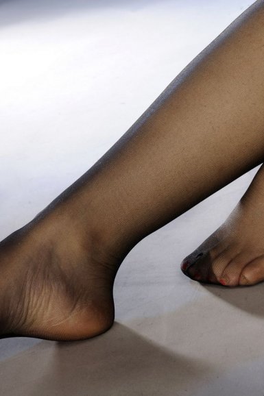 【JBO竞博电竞】驻马店治尖锐湿疣多少费用呢(图3) JBO竞博官网